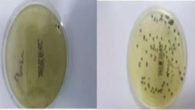 Simitçinin elinde, çiğ köftenin içinde: Sokaktan aldığınız bakteriler böyle görüntülendi!