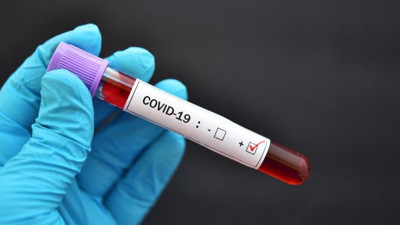 Hasta sayıları kırmızı alarm veriyordu: Pozitif vakalarla ilgili korkunç gerçek!