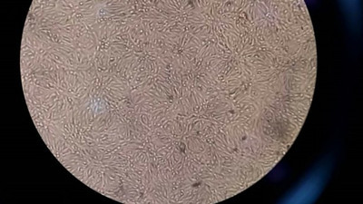 Adıyamanlı Türk bilim adamları başardı: 45 günde korona virüsü tersine döndürüyor