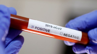 Adıyaman'da 53 ev karantinaya alındı