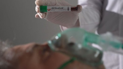 Virüs tedavisinde flaş antikor gelişmesi!