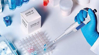 ABD'li Bilim insanları açıkladı! Virüs var ama bulaşmıyor