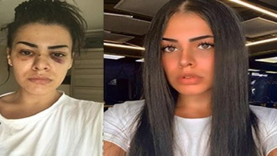 Olacağı buydu! Genç kadın dayak yediğiyle kaldı! Şüpheliler hakkında şok karar! Bostancı'da hem dayak yedi hem tacize uğramıştı