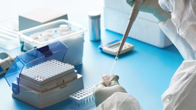 Devlet hastanesi doktoru başardı: Virüslerin çoğalması durduruldu: Helal olsun doktorlarımıza