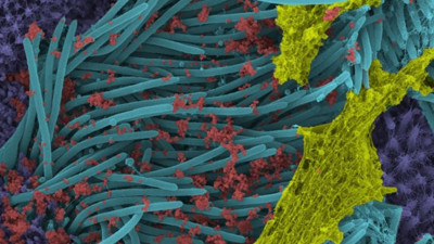 Korona solunum yoluna girip, hücreleri böyle ele geçiriyor… Her şey böyle başlıyor: Tıp dergisinde yayınlandı