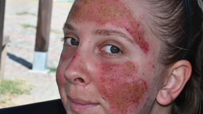 Korktuğu şey başına geldi. Böyleydi, böyle oldu