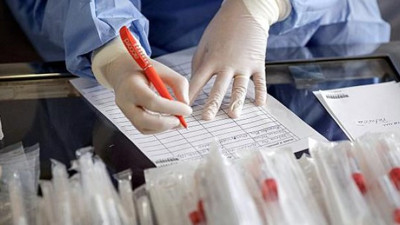 Korona virüs testlerinin arkasındaki gizli gerçek deşifre oldu, eğer doğruysa durum çok vahim