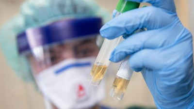 Alman Bilim insanları duyurdu! Korona virüse karşı "yüksek etkili" antikor bulundu