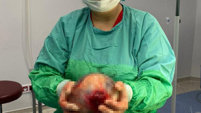 Kasık ağrısıyla hastaneye gitti! Doktorlar bile şaşkına döndü