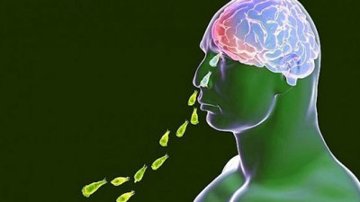 Beyin yiyen amip musluk suyunda çıktı. Kabus gerçek oldu