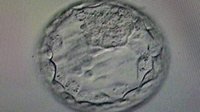 Gebelik yaşı tarihe karıştı. Doç. Dr. Davut Güven müjdeyi verdi