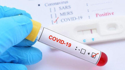 Çorum FK'da korona virüs şoku