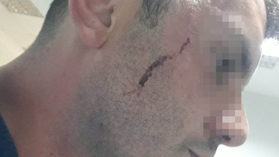 "Hemşire müsait değil" dedi dayağı yedi