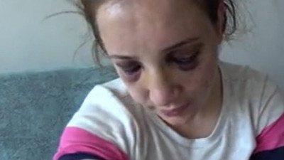 Aile Mahkemesi'nden kadına şiddete kelepçeli önlem. Yüzünü tanınmaz hale getirdi