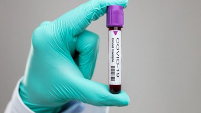 Bilim Kurulu Üyesi koronada kötü haberi duyurdu. Maalesef başarılı olamadı. Her şey sil baştan