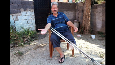 Ayak parmaklarını kaybedip, dizi kesildi. Gençlere uyarı üstüne uyarı yaptı