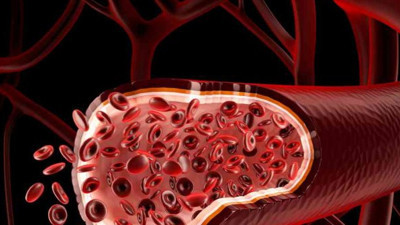 Kandan sinsi sinsi ilerliyor. Günün birinde hayatı kabusa çeviriyor. Bu hastalığa dikkat