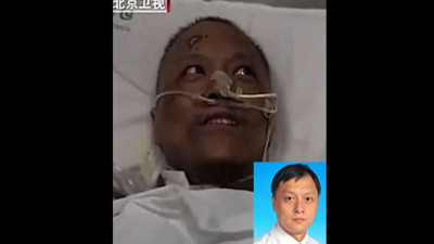 Korona virüs ten rengini değiştirmişti. İşte virüsü atlatan Çinli doktor Yi Fan'ın son görüntüsü