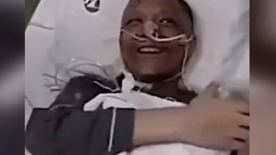 Yedi ayda ten rengi üç sefer değişti. Mucize doktorun son hali şaşkına çevirdi