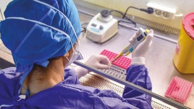 Sağlık Bakanlığı'dan korona test kitleriyle ilgili büyük itiraf geldi. Gerçek aylar sonra ortaya çıktı