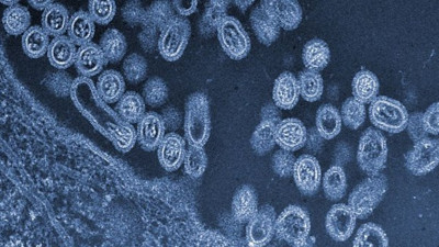 Bilim insanları yeni felaketi böyle duyurdu. Korona bunun yanında hafif kalacak. Tehlikeyi marketlerden eve getiriyoruz