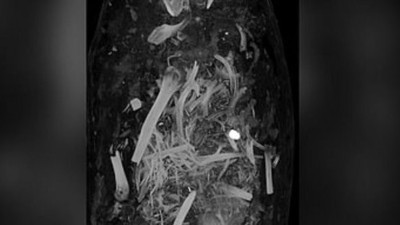 400 yılık sır perdesi aralandı. Tabutun içindekiler olduğu gibi duruyordu. Tomografide ortaya çıktı