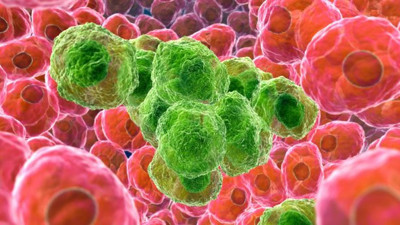 Bilim insanlarından kansere karşı müthiş çözüm. Artık kabus olmaktan çıkacak