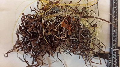 Kaset bandı öldürüyordu son anda kurtarıldı