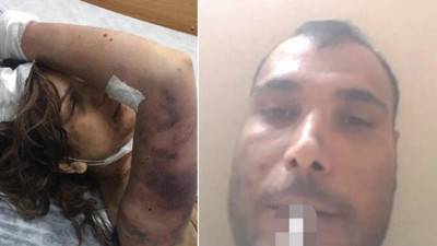 Şanlıurfa’da korkunç olay. Eşini zincirle bağlayıp, kerpetenle tırnaklarını çekmişti. Kan donduran detaylar