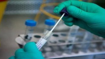 Koronanın yarattığı hasar 3 ay sonra ortaya çıkıyor. Geleneksel yöntemlerle tespit edilemiyor