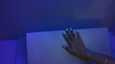 Korona virüsü atlatan kişilerde şok eden tırnak detayı. Parmaklarına bile bakamadılar. İşte ultraviyole cihazında ortaya çıkan o görüntü