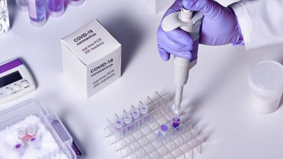 Korona virüs testleri ne kadar güvenilir? Yetkili isim açıkladı