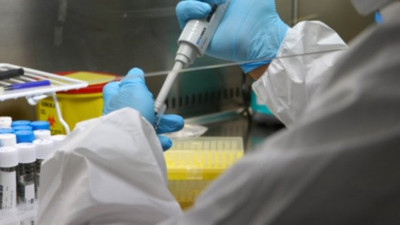 Korona hastalarının yaşama şanslarını bu test belirleyecek. Yeni geliştirildi