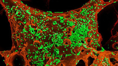 Tüm dünyanın gözü aşıdayken korona tedavisinde ilaç müjdesi geldi. ABD’deki Türk profesör açıkladı. 1 günde iyi ediyor