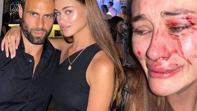 Ukraynalı top model Daria Kyryliuk'tan şoke eden karar, Çeşme’de yediği dayakla gündeme gelmişti