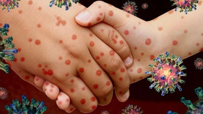 Prof. Dr. Çalışkan tam tarihi verip aşı sıralamasını açıkladı