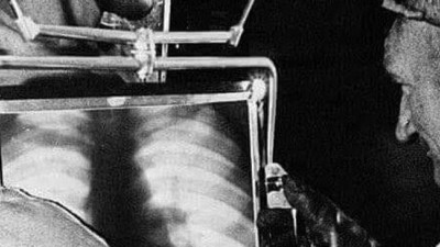 Afrika'da elmas madeninde çalışan işçilerin elmas yutmuş mu diye röntgenini çekiyorlardı. Batı'nın utanç fotoğrafı