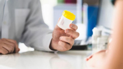 Korona virüsü idrardan tespit edecekler