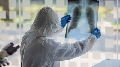 Koronaya yakalanma riskini yüzde 250 artırıyor. Bilim insanları ortaya çıkardı