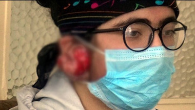 Yağmur Yıldız'ın 7 yaşında taktığı küpeler hayatını kabusa çevirdi. Tedavi olmazsa duyamayacak