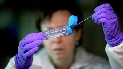 Bilim insanlarından milyonlarca insanın hayatını kurtaracak tedavi. Belden aşağıları felçliydi tekrar yürüdüler