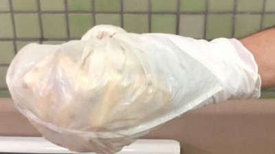 Fişekler halinde midelerinden çıktı