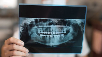 Dişler hakkında hiç bilinmeyen gerçeği duyduğunuzda şaşırıp kalacaksınız