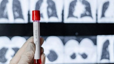 2 milyondan fazla ölü. Kovid-19 vaka sayısı 101 milyonu geçti