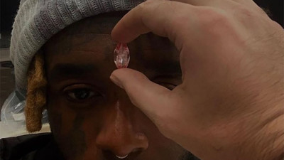 Servetini alnında taşıyor. Ünlü rapçi Lil Uzi Vert, 170 milyon TL’lik elmas taktırdı