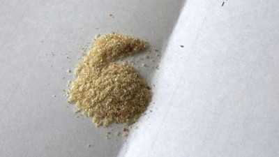 Kanser hücrelerini önce durduruyor sonra öldürüyor. Prof. Dr. Kolaylı açıkladı