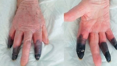 Koronayı atlattım diye sevinme. Başımıza bir de bu geldi