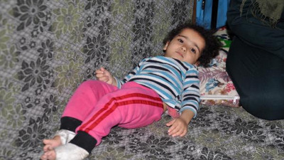 Minik Şirin tedavisi için yardım bekliyor