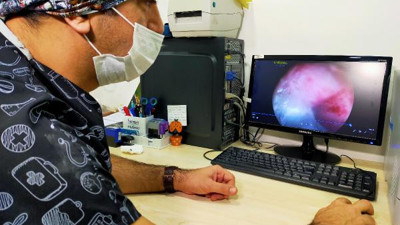 Endoskopi yapan doktor akciğerin içinde gördü gözlerine inanamadı