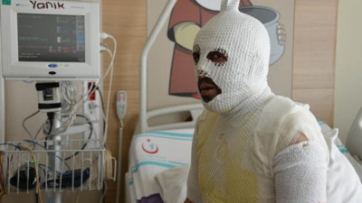 Genç adam bir güğüm suyla haşlandı soluğu hastanede aldı